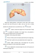 Preview for 86 page of SHNING 3D Aoralscan 2 User Manual