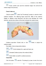 Preview for 87 page of SHNING 3D Aoralscan 2 User Manual