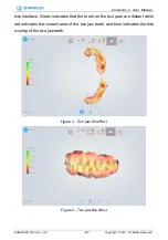 Preview for 88 page of SHNING 3D Aoralscan 2 User Manual