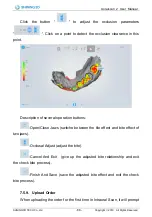 Preview for 89 page of SHNING 3D Aoralscan 2 User Manual