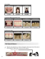 Предварительный просмотр 32 страницы Shofu EyeSpecial C-3 Advanced Manual