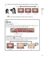 Предварительный просмотр 33 страницы Shofu EyeSpecial C-3 Advanced Manual