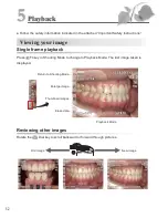 Предварительный просмотр 58 страницы Shofu EyeSpecial C-3 Advanced Manual