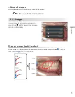 Предварительный просмотр 61 страницы Shofu EyeSpecial C-3 Advanced Manual