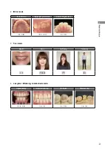 Preview for 35 page of Shofu EyeSpecial C-IV Advanced Manual