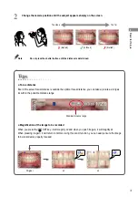 Preview for 37 page of Shofu EyeSpecial C-IV Advanced Manual