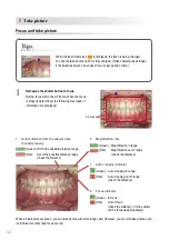 Предварительный просмотр 38 страницы Shofu EyeSpecial C-IV Advanced Manual