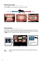 Предварительный просмотр 66 страницы Shofu EyeSpecial C-IV Advanced Manual