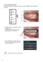 Предварительный просмотр 72 страницы Shofu EyeSpecial C-IV Advanced Manual