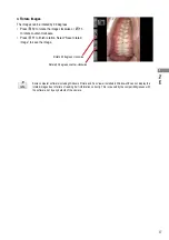 Предварительный просмотр 73 страницы Shofu EyeSpecial C-IV Advanced Manual