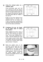 Предварительный просмотр 15 страницы Shofu Pro Arch IIG Instructions For Use Manual