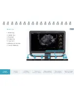 Preview for 5 page of Siemens ACUSON NX3 series Quick Reference Manual