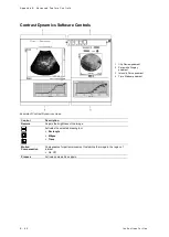 Preview for 438 page of Siemens Acuson S2000 Instructions For Use Manual