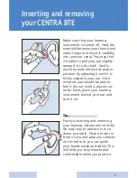 Предварительный просмотр 11 страницы Siemens CENTRA Behind-the-Ear System User Manual