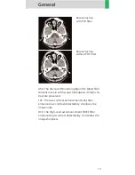 Preview for 13 page of Siemens SOMATOM Emotion 6 Application Manual