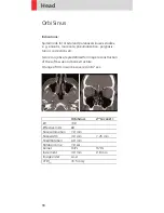 Preview for 90 page of Siemens SOMATOM Emotion 6 Application Manual