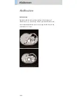 Preview for 140 page of Siemens SOMATOM Emotion 6 Application Manual