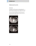 Preview for 144 page of Siemens SOMATOM Emotion 6 Application Manual