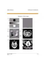 Preview for 531 page of Siemens SOMATOM Emotion syngo CT 2007E Operator'S Manual