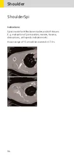 Preview for 96 page of Siemens SOMATOM Sensation 16 Application Manual