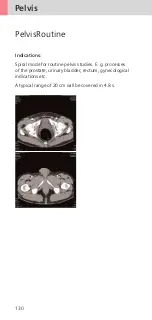 Preview for 130 page of Siemens SOMATOM Sensation 16 Application Manual