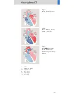 Предварительный просмотр 23 страницы Siemens SOMATOM Sensation Cardiac Version A60 Application Manual