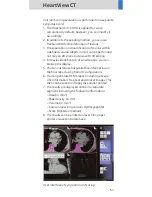 Preview for 53 page of Siemens SOMATOM Sensation Cardiac Version A60 Application Manual