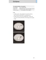 Preview for 85 page of Siemens SOMATOM Sensation Cardiac Version A60 Application Manual