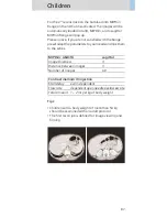 Preview for 87 page of Siemens SOMATOM Sensation Cardiac Version A60 Application Manual