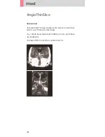 Preview for 92 page of Siemens SOMATOM Sensation Cardiac Version A60 Application Manual