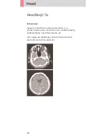 Preview for 94 page of Siemens SOMATOM Sensation Cardiac Version A60 Application Manual