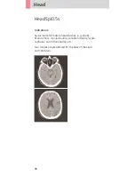 Preview for 96 page of Siemens SOMATOM Sensation Cardiac Version A60 Application Manual