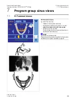 Preview for 45 page of Sirona Orthophos XG Plus DS/Ceph Operating Instructions Manual