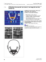 Preview for 48 page of Sirona Orthophos XG Plus DS/Ceph Operating Instructions Manual