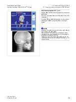 Preview for 73 page of Sirona Orthophos XG Plus DS/Ceph Operating Instructions Manual