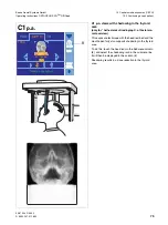 Preview for 79 page of Sirona Orthophos XG Plus DS/Ceph Operating Instructions Manual