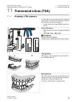 Preview for 87 page of Sirona Orthophos XG Plus DS/Ceph Operating Instructions Manual