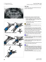 Preview for 88 page of Sirona Orthophos XG Plus DS/Ceph Operating Instructions Manual