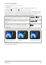 Preview for 12 page of SKF TKTI 10 Instructions For Use Manual