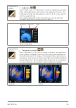 Preview for 20 page of SKF TKTI 10 Instructions For Use Manual