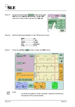 Предварительный просмотр 138 страницы SLE SLE5000 Model J Service Manual