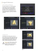 Preview for 16 page of Smith & Nephew JOURNEY II BCS Manual