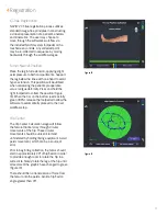 Preview for 17 page of Smith & Nephew JOURNEY II BCS Manual