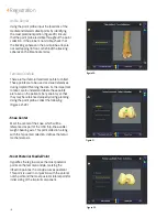 Preview for 18 page of Smith & Nephew JOURNEY II BCS Manual