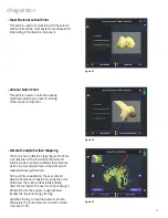 Preview for 19 page of Smith & Nephew JOURNEY II BCS Manual