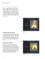 Preview for 20 page of Smith & Nephew JOURNEY II BCS Manual