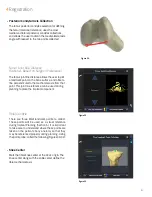 Preview for 21 page of Smith & Nephew JOURNEY II BCS Manual