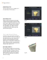 Preview for 22 page of Smith & Nephew JOURNEY II BCS Manual