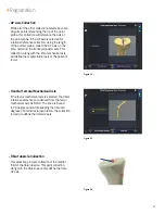 Preview for 23 page of Smith & Nephew JOURNEY II BCS Manual