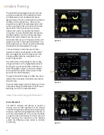 Preview for 26 page of Smith & Nephew JOURNEY II BCS Manual